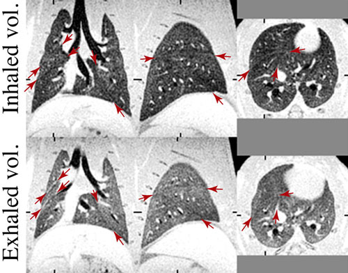 ABQMR Lung Imaging